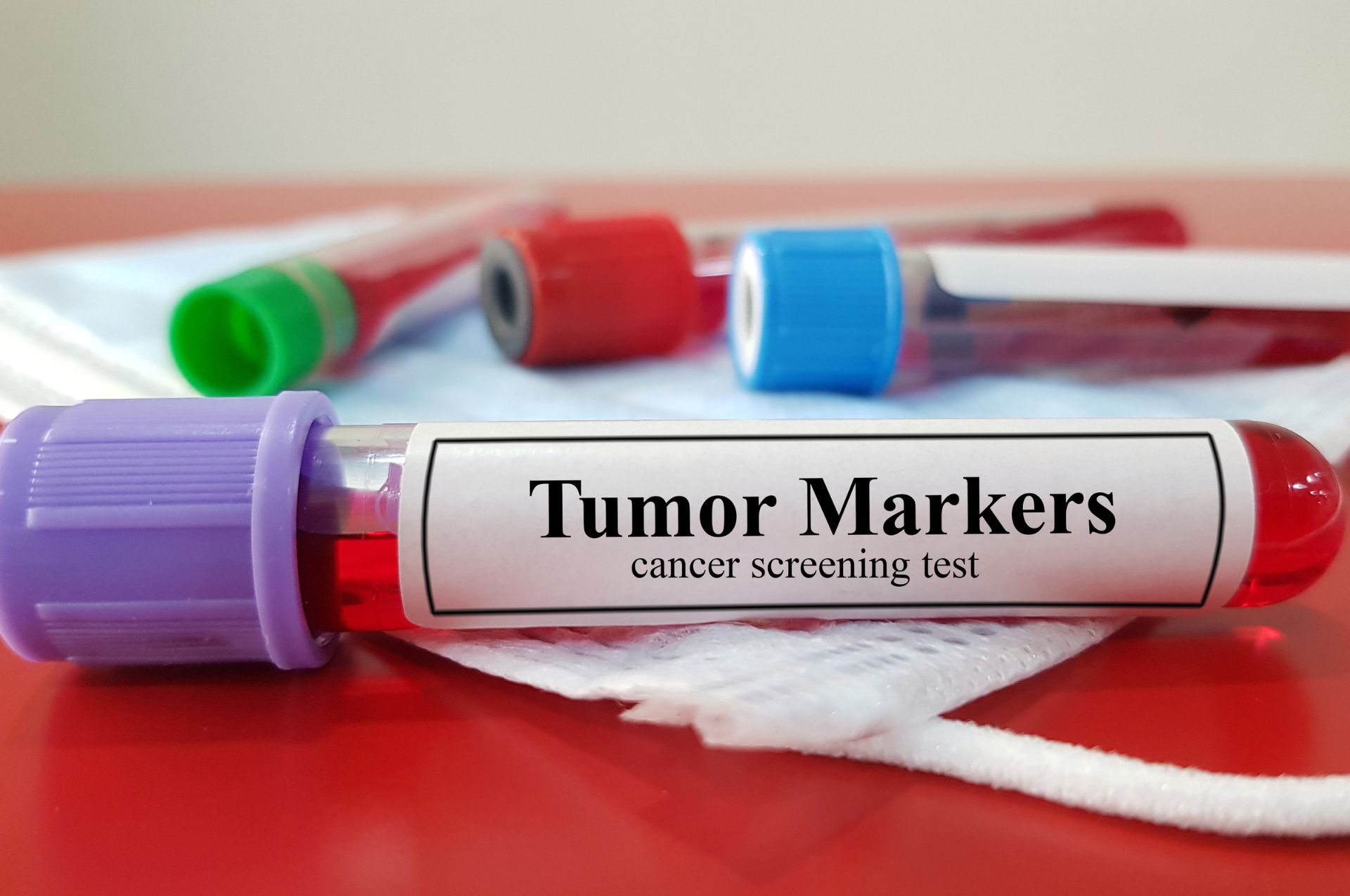 When Your Doctor Needs a Tumor Marker or Cytology Test